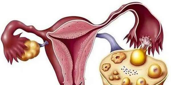 卵泡发育不良做试管婴儿成功率是多少？真实数据并不理想