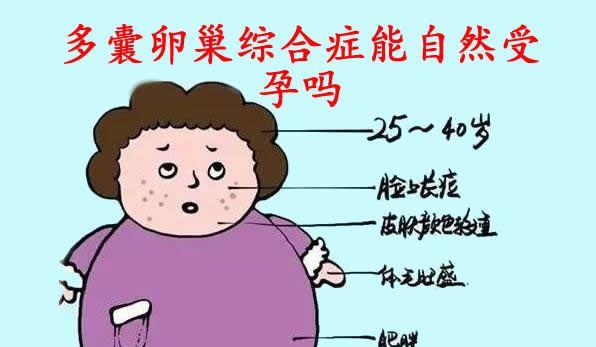 多囊卵巢综合症能自然受孕吗？看完不用担心了