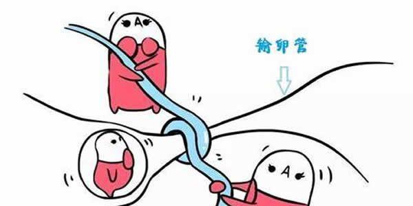 分享治疗输卵管堵塞最先进的5种办法-建议收藏