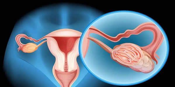 科普-女性明明有两个卵巢为什么每次只能排出一颗卵