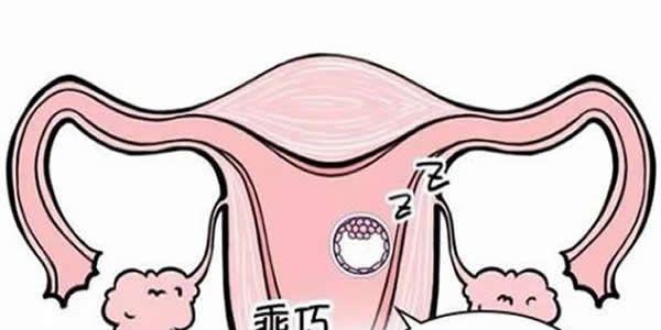 试管婴儿移植后女性需要注意这7点-提高成功率节约费用