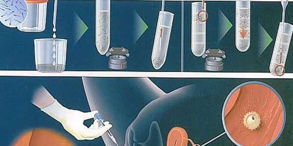 女人做试管过程痛苦吗？了解了过程才知道真相不简单