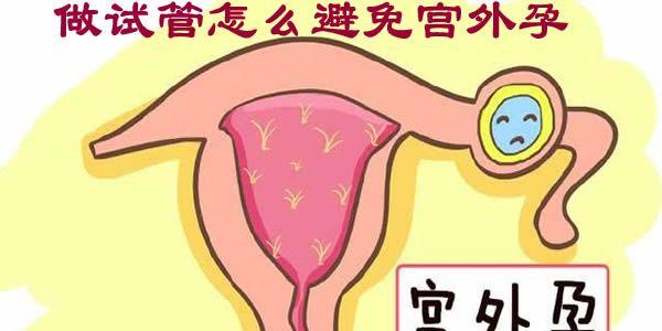 做试管婴儿怎么样避免宫外孕？这3个建议你必须要认真看