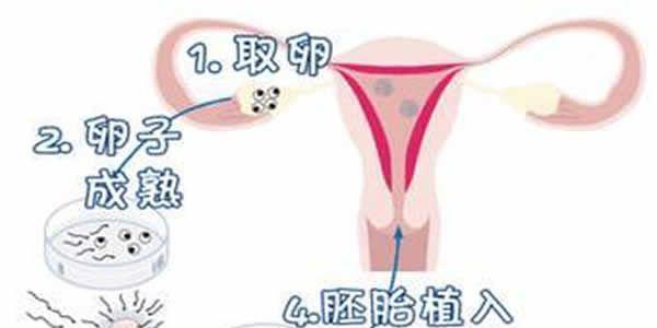 看完做试管婴儿的全过程后-特别心疼女性