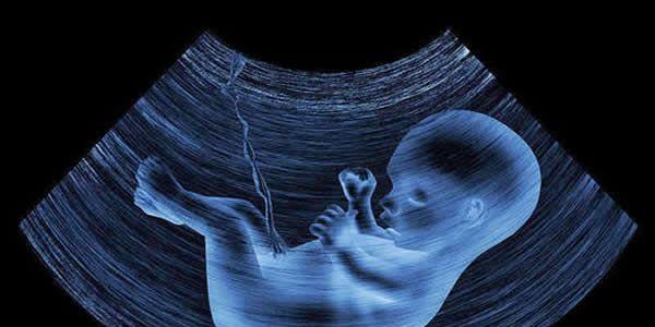 孕囊形状看男孩女孩-孕囊大小看胎儿性别-孕囊b超单图解