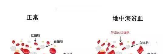 关于第三代试管婴儿可筛选遗传病-地中海贫血的报告解读