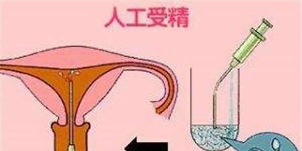 人工授精最好的医院-全国人工授精医院排行榜给到你