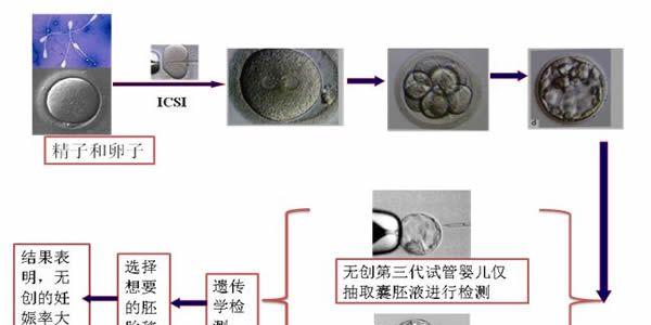 试管婴儿能选择性别吗 技术上可以, 法律上不行