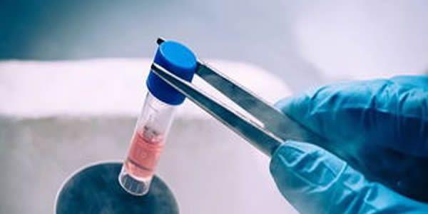 解冻移植前检查项目，这份明细表让你看得一清二楚