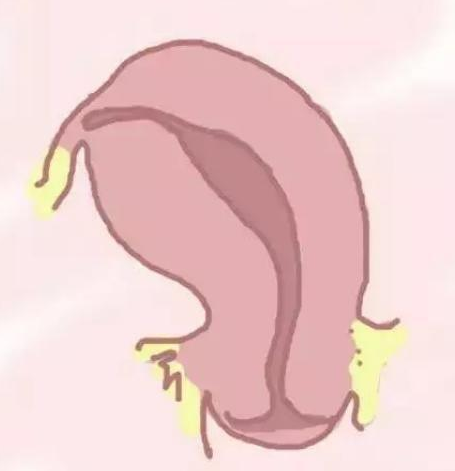 关于始基子宫的这些你要知道-成因，症状，治疗