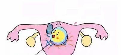 宫腔粘连的两大危害不仅影响月经还会影响生育！必须要重视！