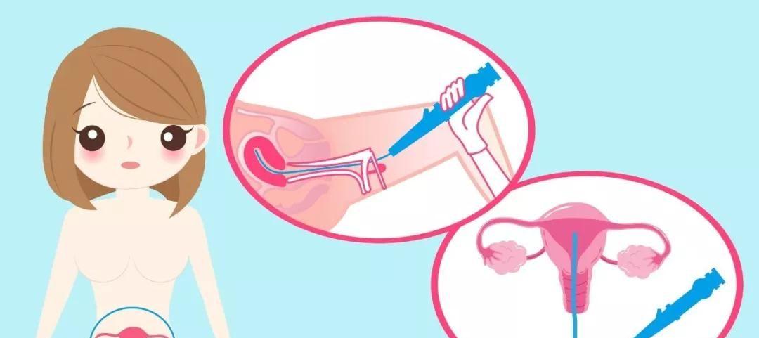 用最简洁的文字让你了解宫腔粘连的危害和诊断以及治疗方式