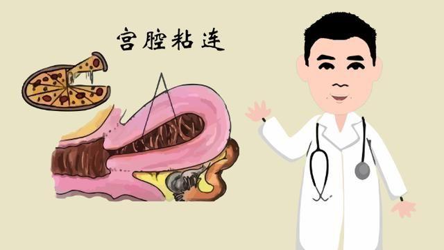 宫腔粘连产生的原因是什么怎么治？这篇文章让你了然于心
