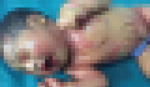 太恐怖！新妈妈生下火棉胶婴儿被吓哭…