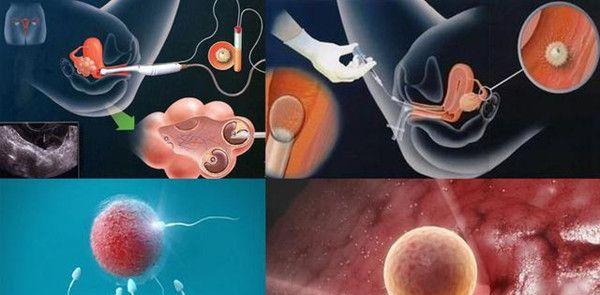 怀孕生子过程详细步骤操作流程图解
