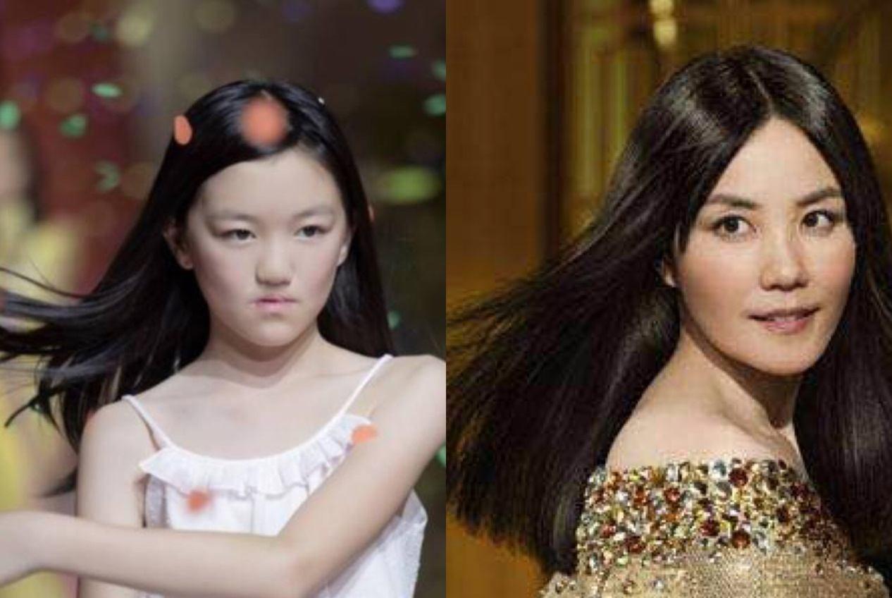 李嫣然唇腭裂：内附唇腭裂图片