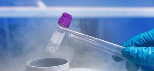 冻卵-专家建议女性不要轻易选择