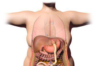 肥胖是引起多囊卵巢综合征不孕的特征之一