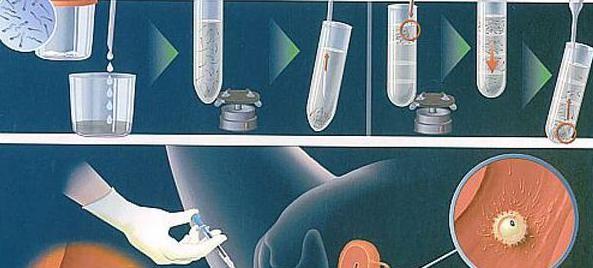 试管婴儿流程6个步骤的通俗易懂讲解
