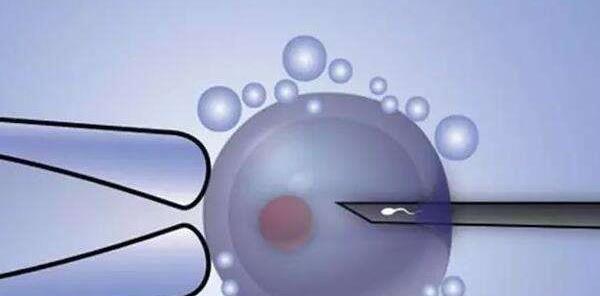 揭秘茂名单身未婚试管真相，4大费用保守估计30万！