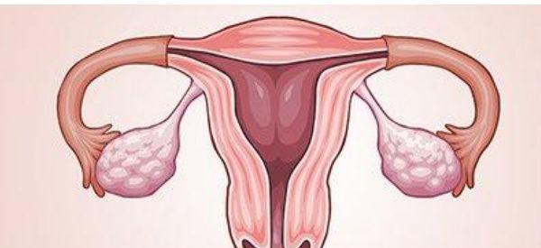 子宫内膜异位症可以直接做试管吗？主要看你是否符合条件