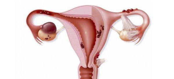 卵巢早衰试管移植影响胚胎着床吗？附胚胎移植注意要点