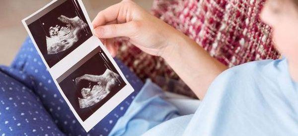 有子宫没有卵巢可以做试管婴儿吗？她就成功了