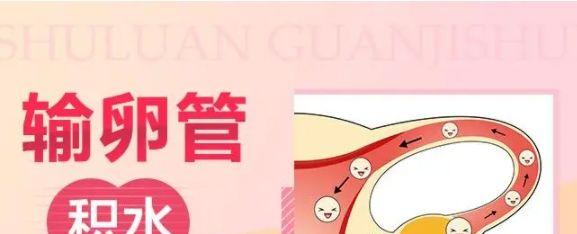 输卵管两侧都堵了还有积水能试管吗？