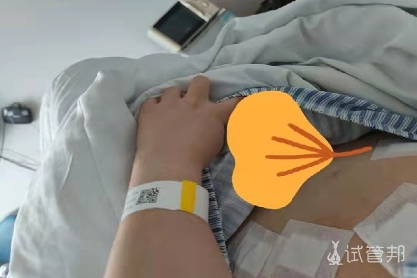 秦皇岛市妇幼保健院试管婴儿取卵详细流程分享