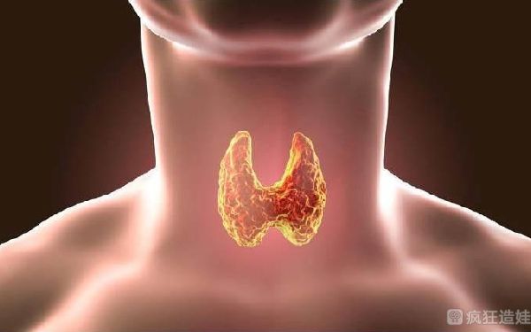 甲亢影响第三代试管婴儿移植吗？什么是甲亢？