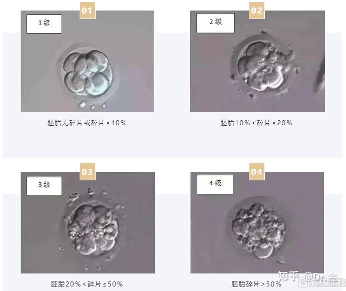 供卵三代试管婴儿反复失败？胚胎碎片要重视！