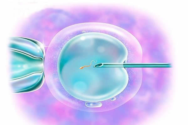 试管婴儿和正常婴儿一样吗-寿命、智商是不是不一样