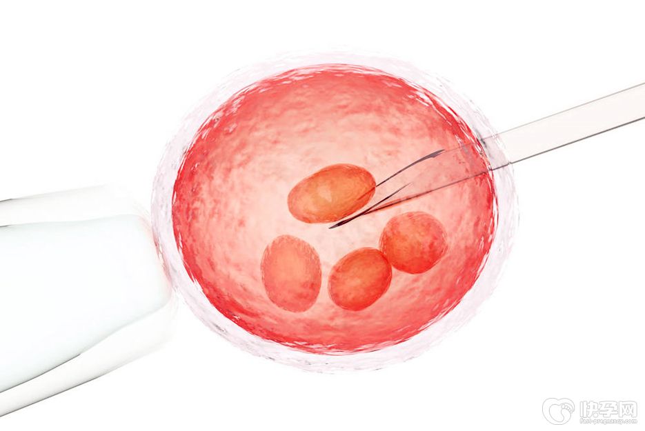试管婴儿可以全麻吗？专家告诉你试管婴儿手术最全攻略