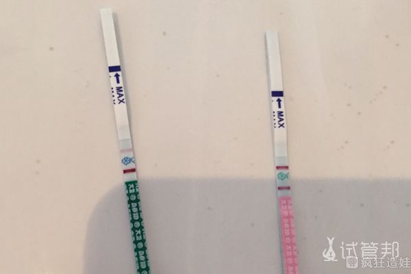 宫外孕流产后，准备去澳门镜湖医院做第三代试管婴儿