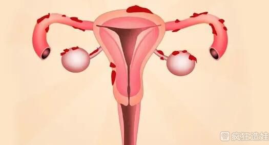 子宫全切后还能做第三代试管婴儿吗？没子宫能不能生育？