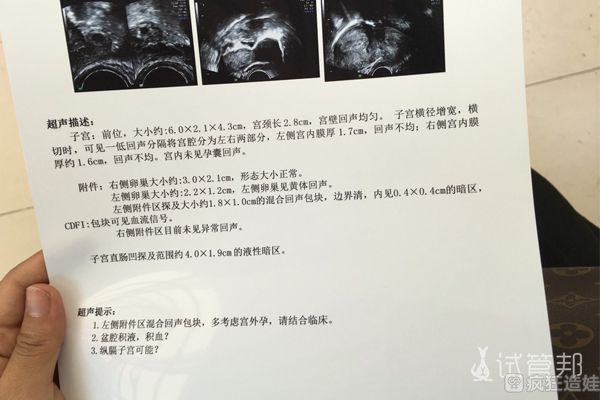 2次宫外孕折腾3年，第二代试管婴儿终于怀上了