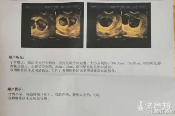 二代试管婴儿移植3次都出现着床失败，第4次我终于好孕了！！