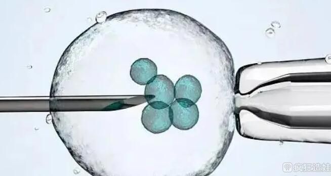 贵阳做借卵三代试管婴儿排名怎么样？附详细介绍？