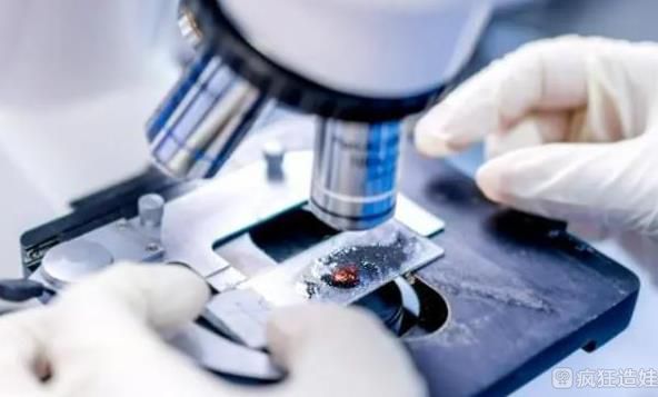 专家说哪三种女人不能做第三代试管婴儿？女性年龄超过40还可以吗？