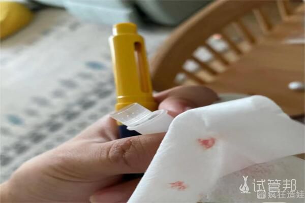 大连市妇女儿童医疗中心做第二代试管婴儿：促排取卵注意事项