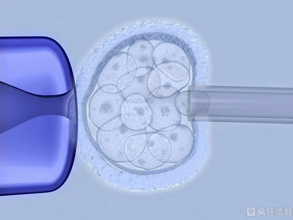 试管三代技术可以筛查哪些问题，这份清单赶紧收藏！