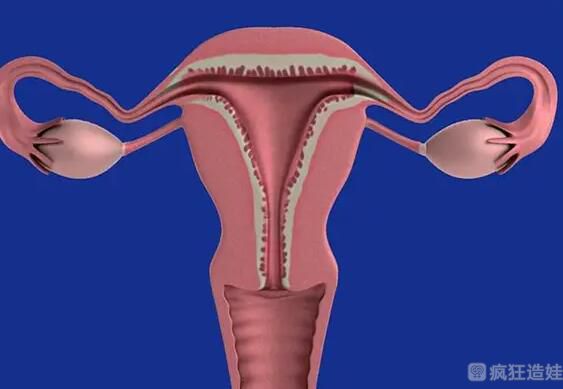 子宫先天发育不良能做第三代试管婴儿吗？子宫对第三代试管婴儿的影响？