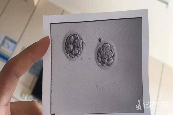 分享在马鞍山市妇幼保健院试管婴儿的感受 希望大家好孕