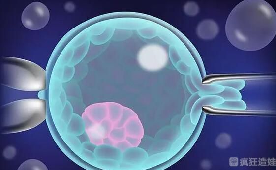 香港做第三代试管婴儿一定能生儿子吗？附详细流程？