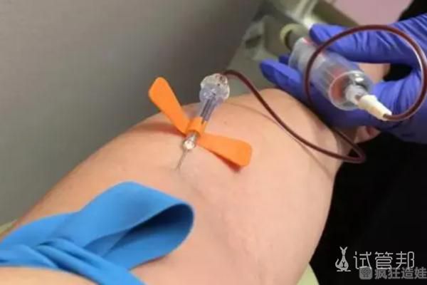 老公精子畸形率达98%，在重庆做第二代试管婴儿成功好孕