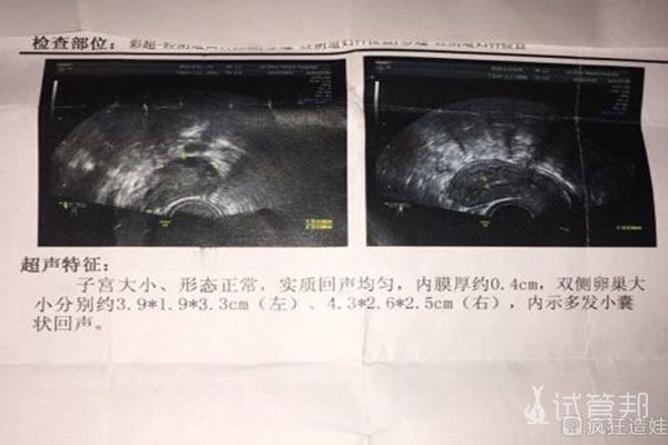 准备在武汉大学中南医院做二代试管婴儿了，有同行的吗