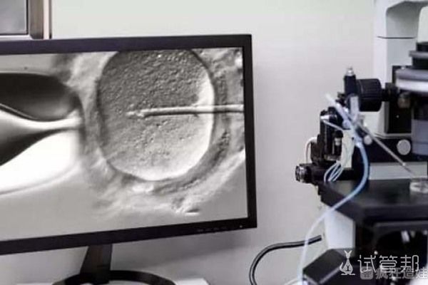 多囊卵巢受孕难，中山六院做第二代试管婴儿成功经验