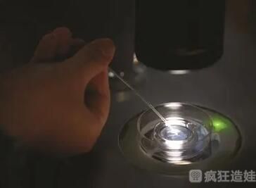 使用供卵做试管婴儿需要哪些检查？附检查详情？