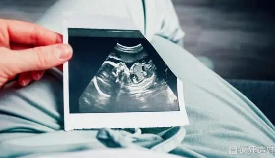 我想做第二代试管婴儿生一个男孩多少钱？想做第二代试管婴儿男孩费用？