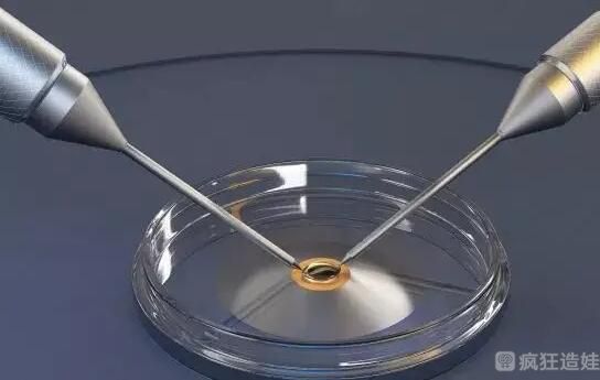 借卵做二代试管婴儿的流程？附详细借卵二代试管婴儿费用